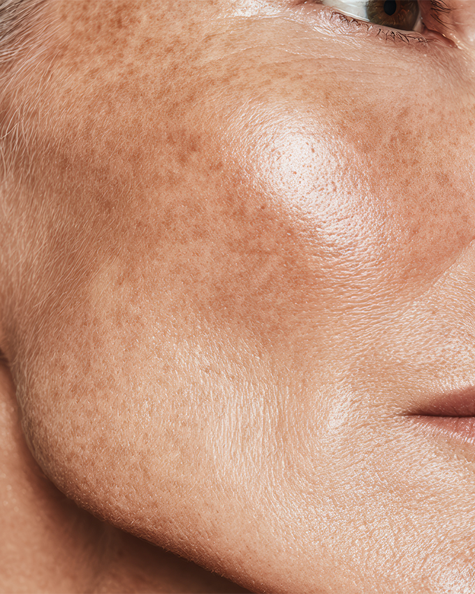 Skin problems on the face during menopause